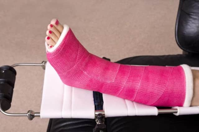 Around two fifths of all women over 50 will suffer a major fractures caused by brittle bones during the remainder of their lifetimes