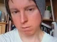 Nicholas Chadwick is now bald, say police