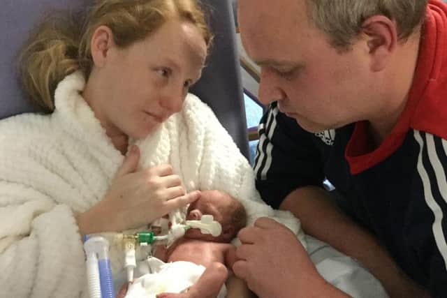 Georgia Rae was born seven weeks early, weighing less than three pounds