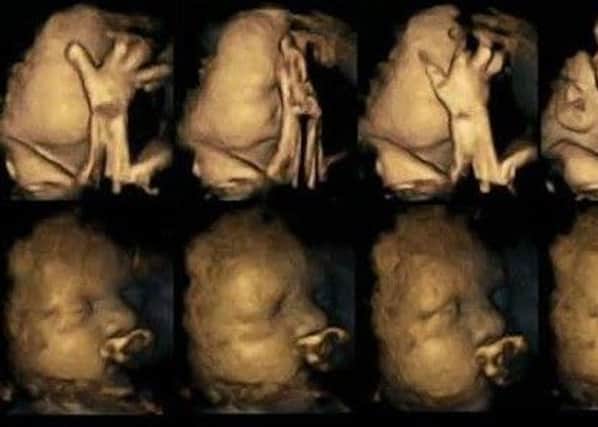 Foetus  Credit: Dr Nadja Reissland, Durham University.