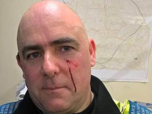 PCSO Jimmy Staniforth was hit below the eye by a stone thrown by one of the youths in Shiregreen
