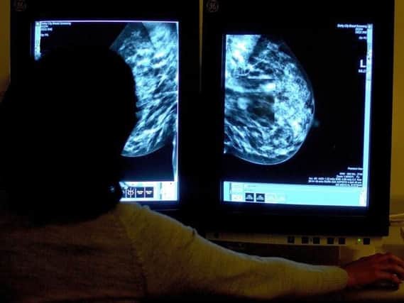 File picture of a consultant studying a mammogram. Hundreds of thousands of women were not invited for routine breast cancer screening due to an administrative error, it has been reported (Photo: PA).