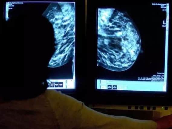 A computer system failure meant women were not invited to their final routine breast screening (Pic: PA)