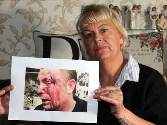 Diane Timms says she is angry at how police have handled the attack on her son Lawrence Vincent