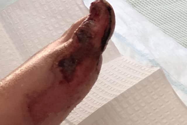 Elliott Appleby's injuries.