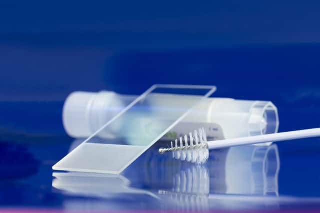 At-home smear tests to be trialled by thousands of UK women in bid to ...